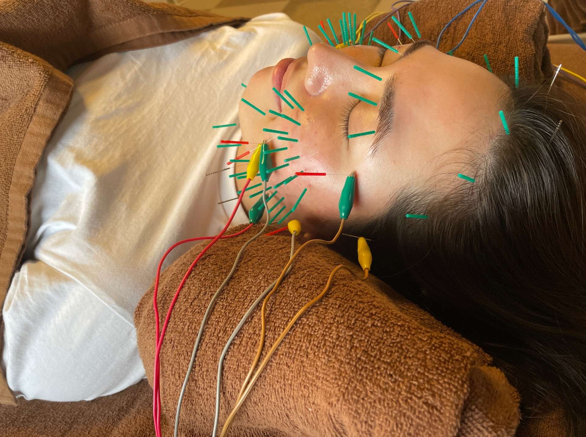 小顔・美容メニュー