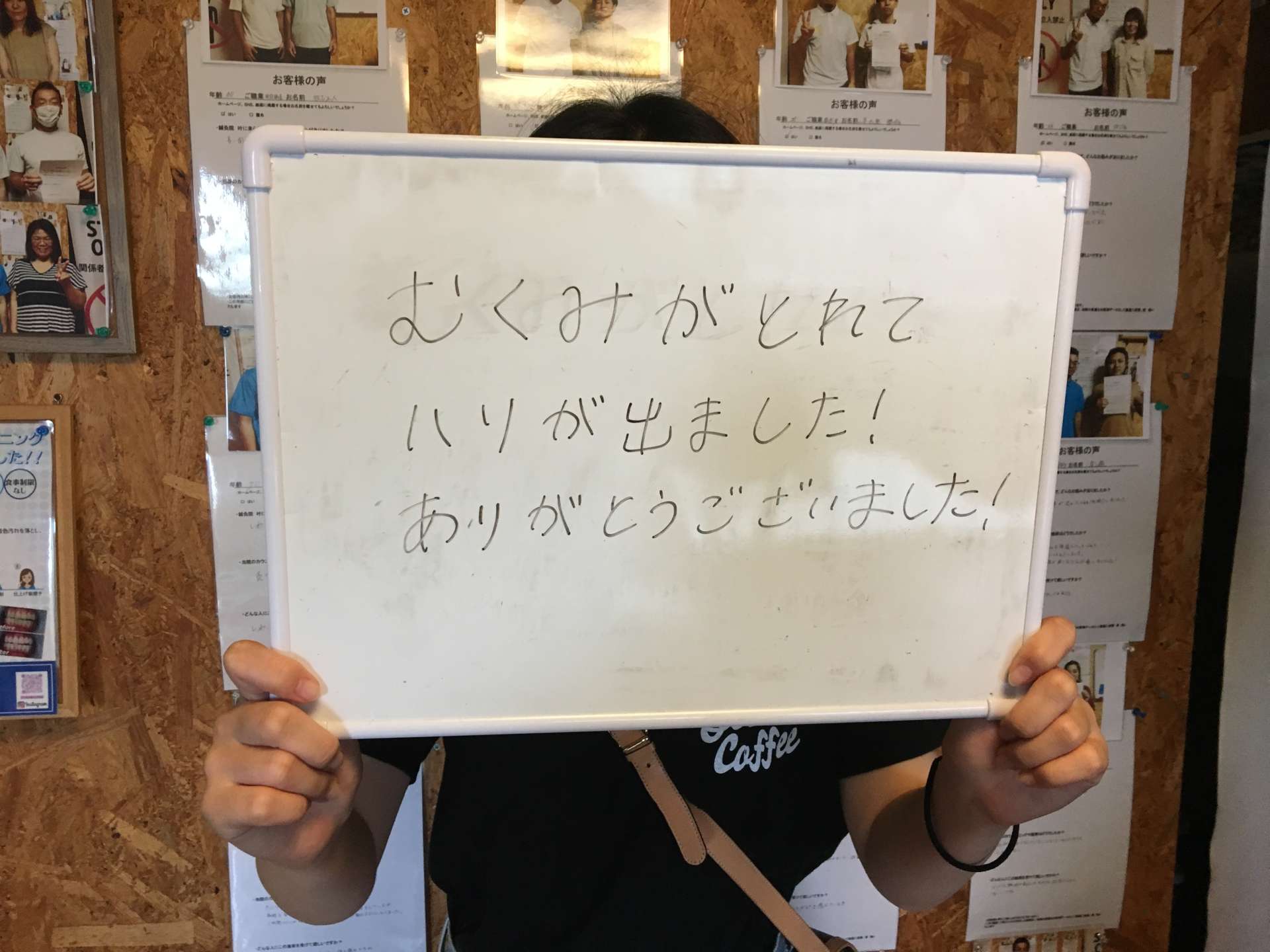 【浦添市の鍼灸院I鍼灸院 叶】 美容鍼の施術後の感想